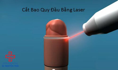 cắt bao quy đầu bằng laser