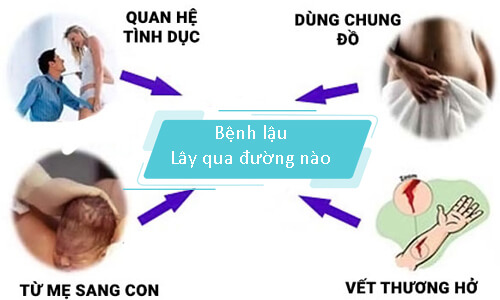 bệnh lậu lây qua đường nào