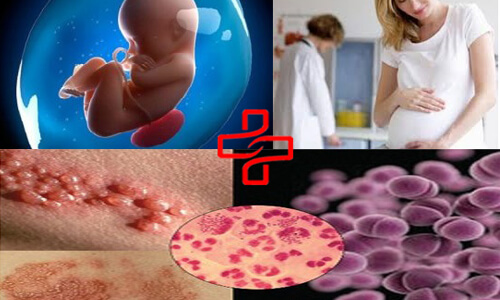 dấu hiệu bệnh lậu ở phụ nữ mang thai